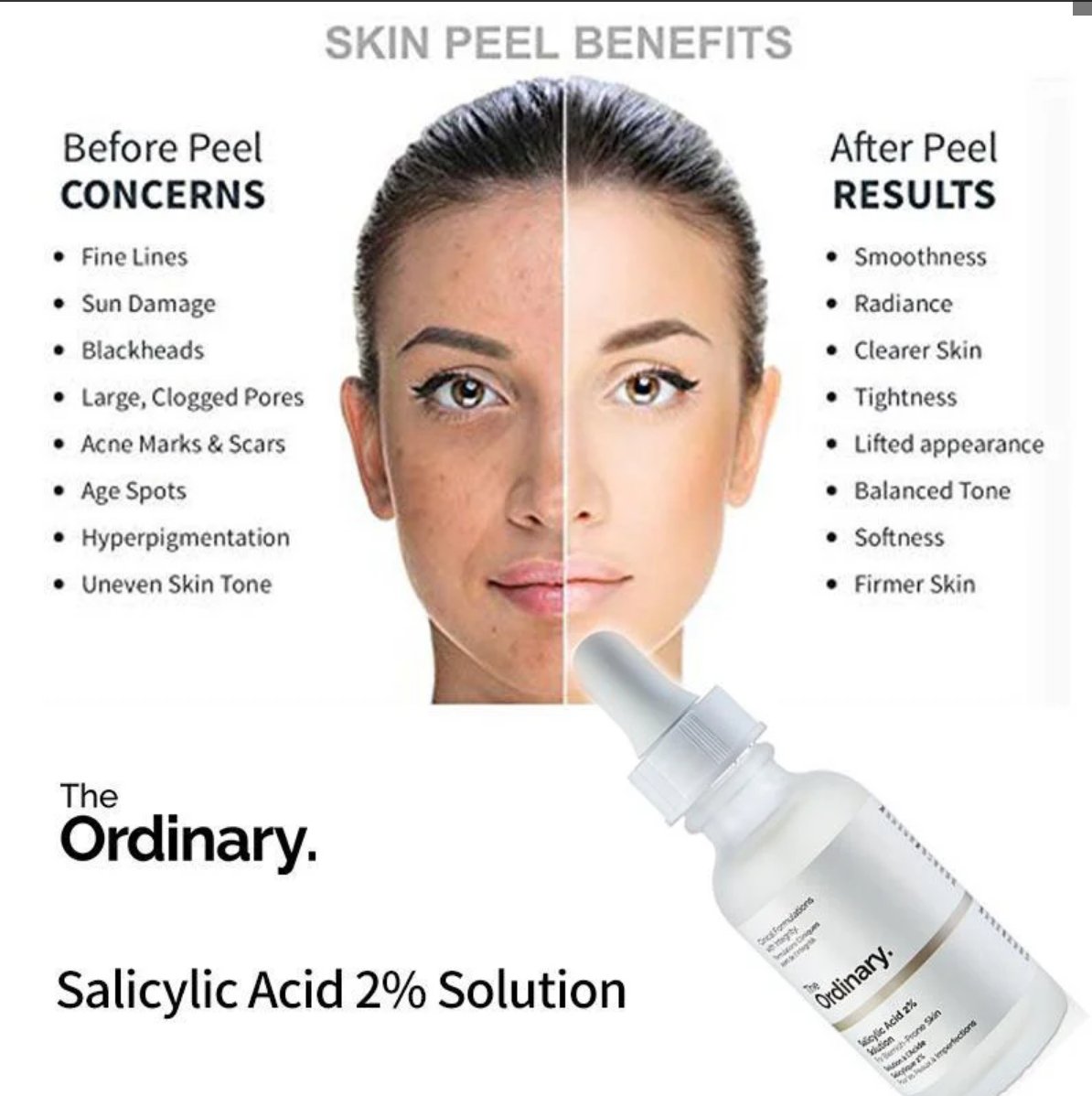 Salicylic Acid 2% Solution 50 ml